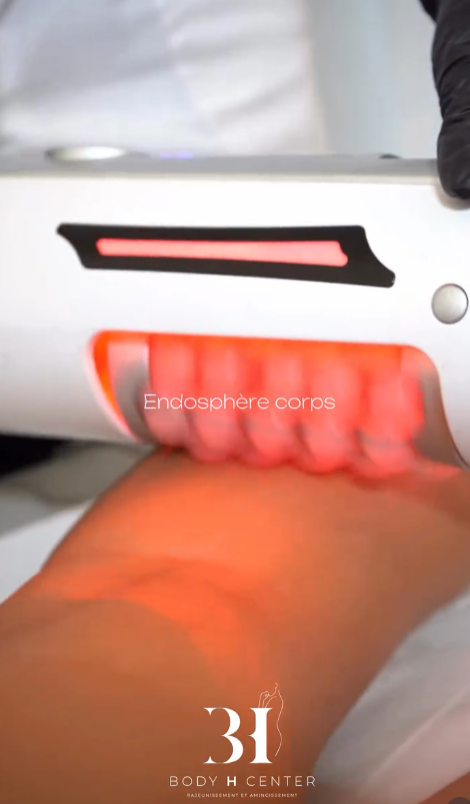 Endosphère corps et minceur Paris