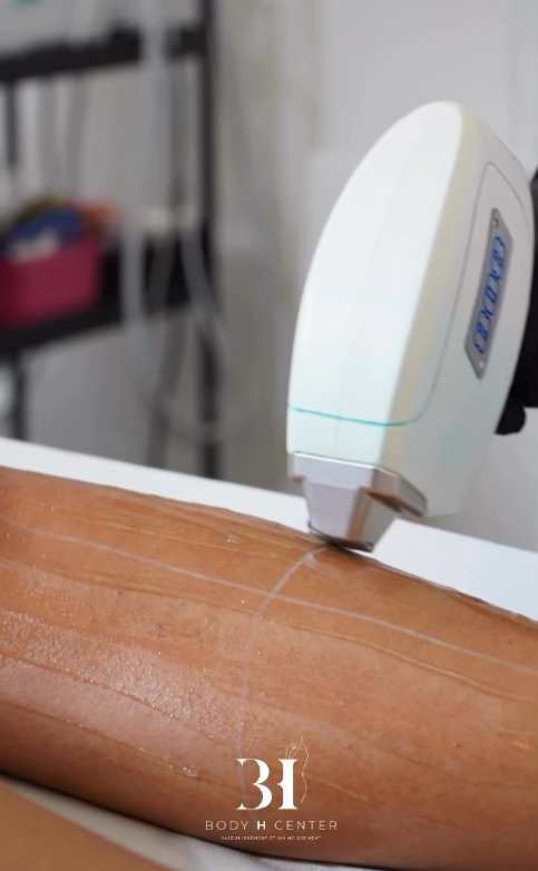 Épilation laser diode Paris 8